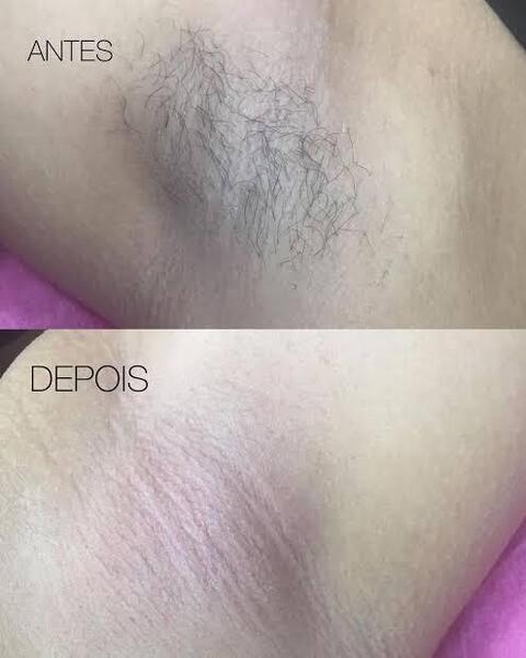 Imagem do serviço 