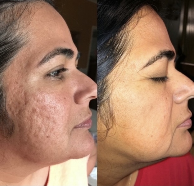 Best Facial Treatment Near Me | Elixir Aesthetics Clinic 
