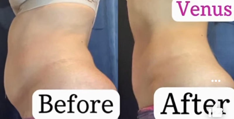 body and face clinic in Denver | Elixir Aesthetics Clinic 
