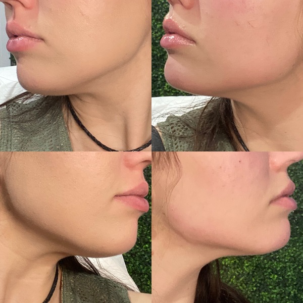 Aesthetics Med Spa | Denver Aesthetics | Elixir Aesthetics Clinic 

