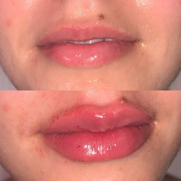 Peeling Skin Treatment | Medical Wellness Services
