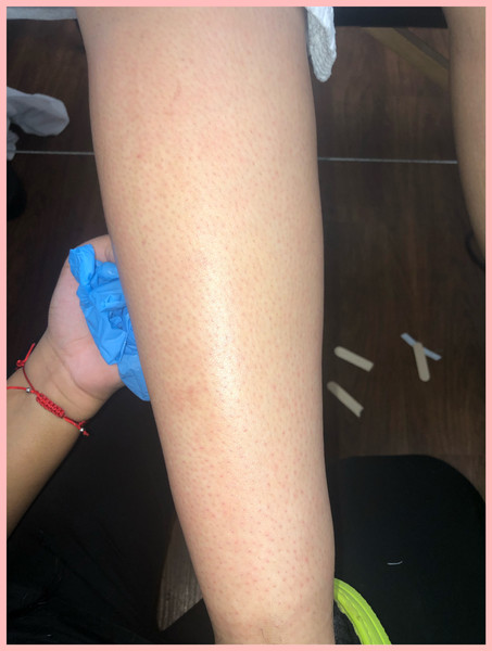 Leg Wax