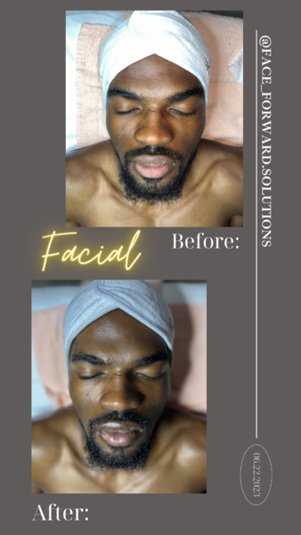 Basic Facial 