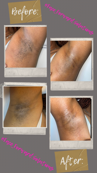 Underarm Wax