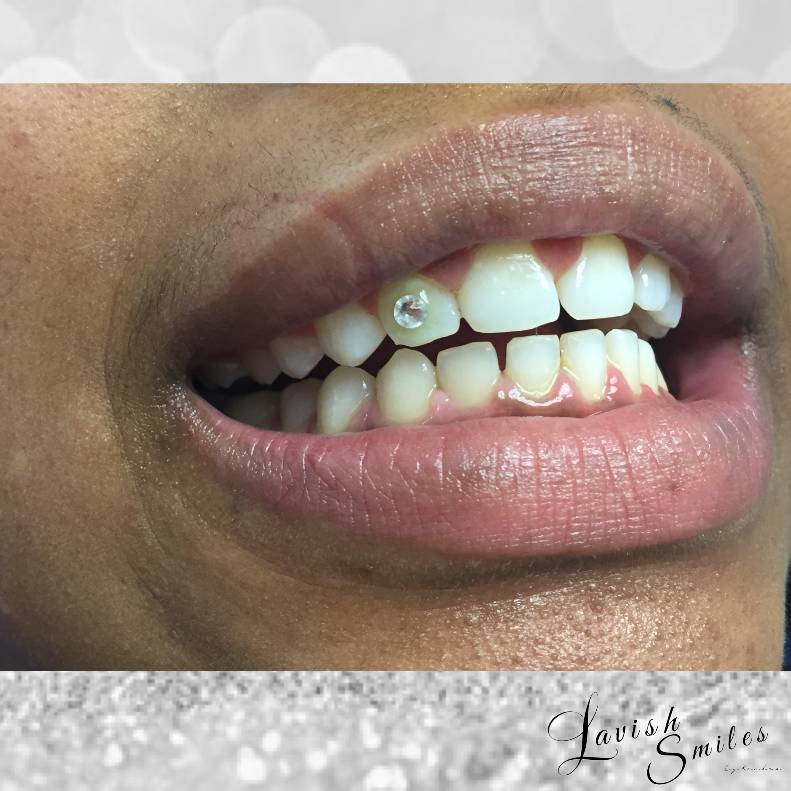 Tooth Gems & Teeth Whitening — The Lash Bar & More