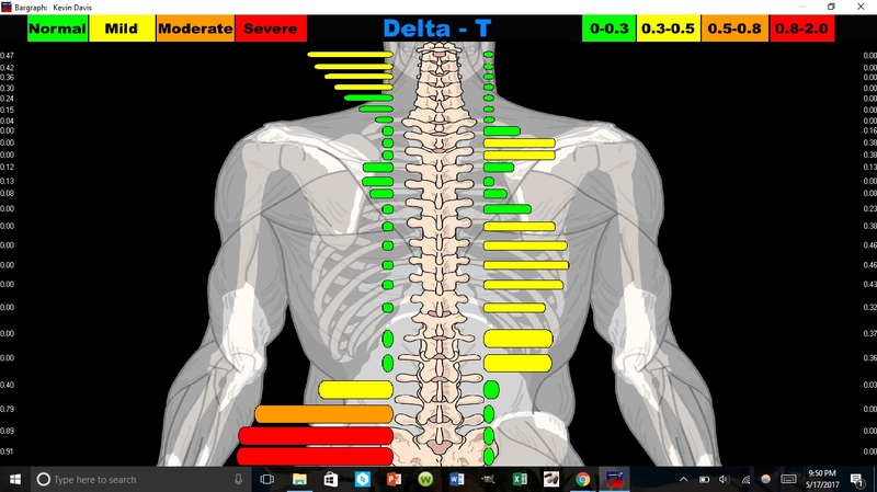 Nervous System Scan, checking for nerve interference in the spinal column